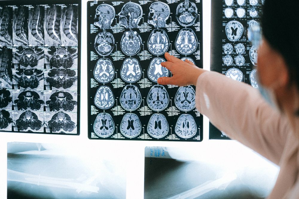 Radiologist reviewing brain MRI scans